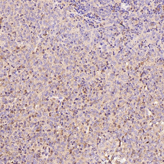 IHC - Anti-active + pro Caspase 3 CASP3 Rabbit Monoclonal Antibody ABO14291